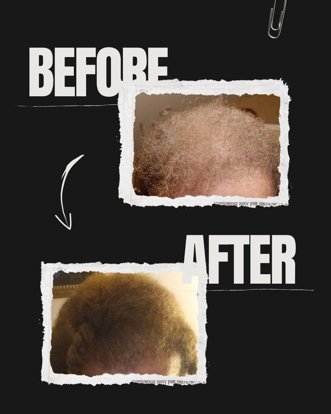 Mushroom and Herbal Hair Growth Oil 2oz - SHREMEDY