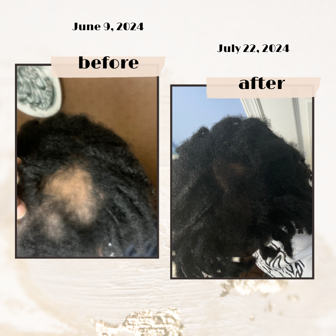 Mushroom and Herbal Hair Growth Oil 2oz - SHREMEDY